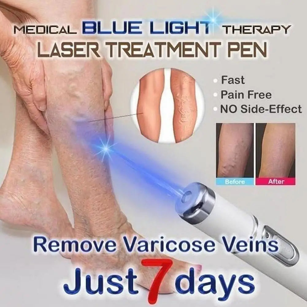 Spataderlampenkap Therapy Effective Improve Blood Circulation Relieve Varicose Veins Vasculitis Leg Flebitis Care Products Daily
