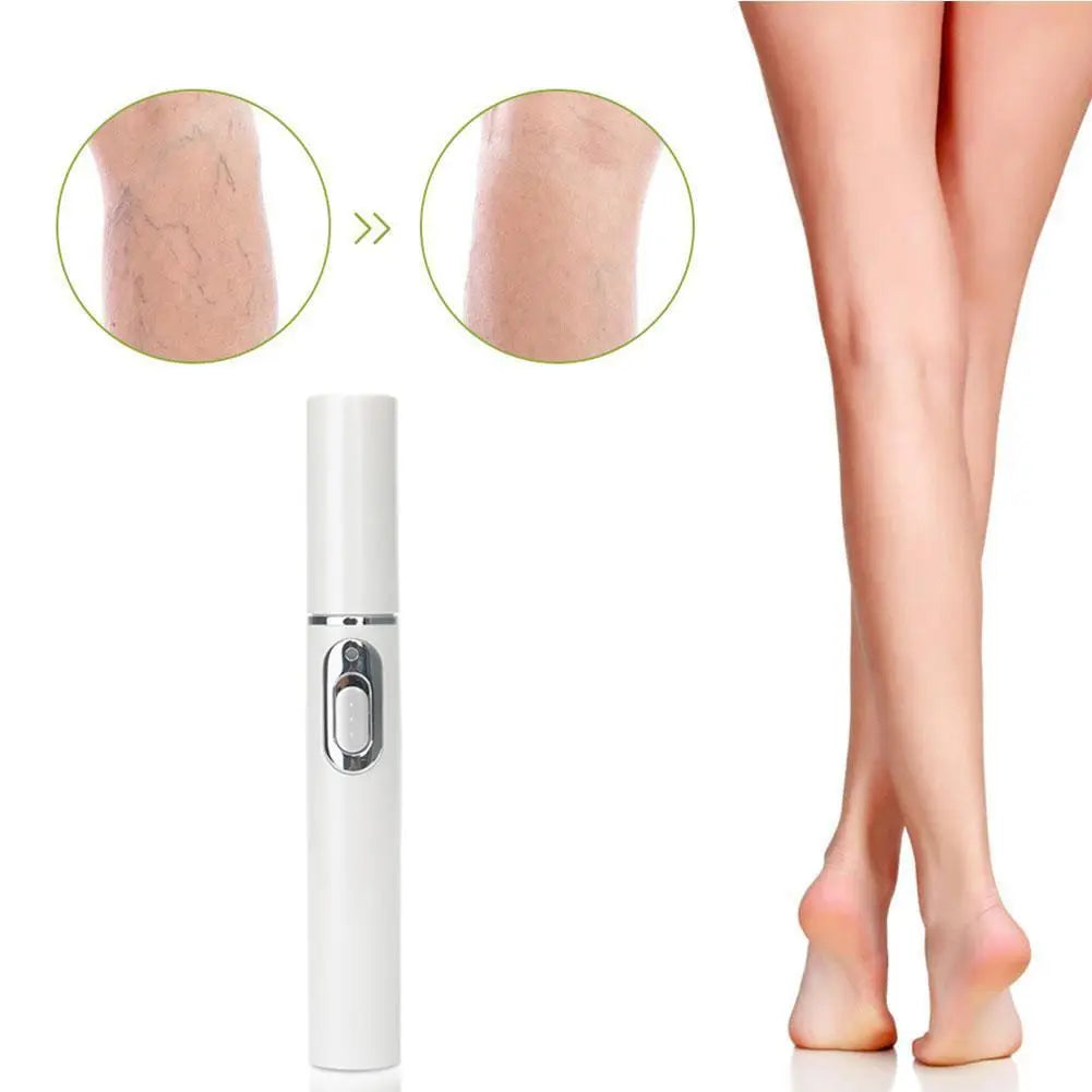 Spataderlampenkap Therapy Effective Improve Blood Circulation Relieve Varicose Veins Vasculitis Leg Flebitis Care Products Daily